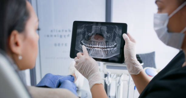 Licensed Tooth Extraction service in Port Arthur, TX - Smile Center Dentistry